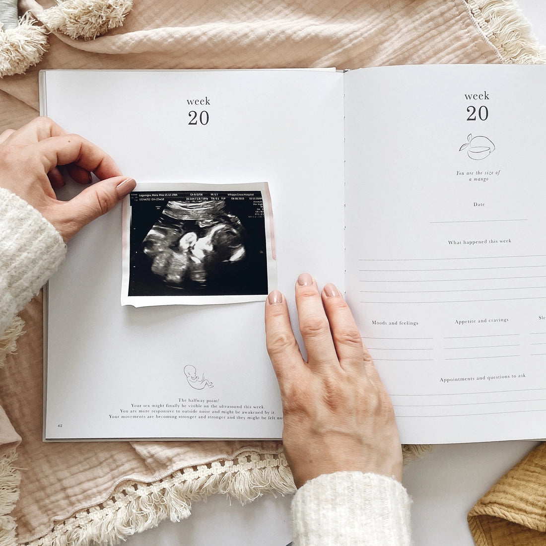 Pregnancy Journal